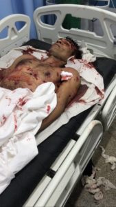 24fa1158-8264-40c9-b2c0-8c7e0b6b60f7-169x300 Lázaro Barbosa é morto pela polícia de Goiás