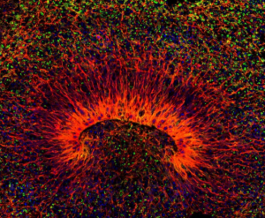 image-19-300x247 Ayahuasca: A nova ciência psicodélica
