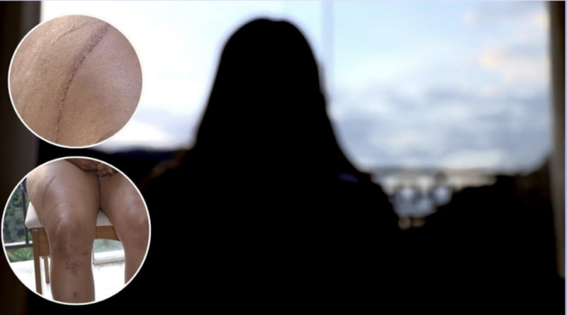 Mulher atravessa área de mata fugindo do ex companheiro em Santa Teresa