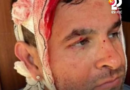 Segurança de Lula é golpeado por tacape durante encontro em Aracruz