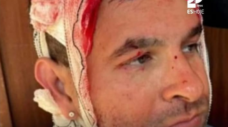 Segurança de Lula é golpeado por tacape durante encontro em Aracruz